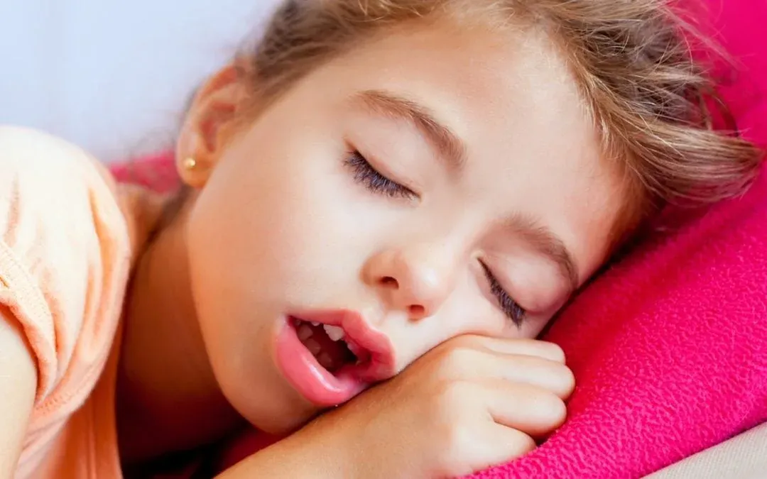 Criança dormindo de lado com a boca aberta, sinal comum de obstrução nasal por adenoide aumentada